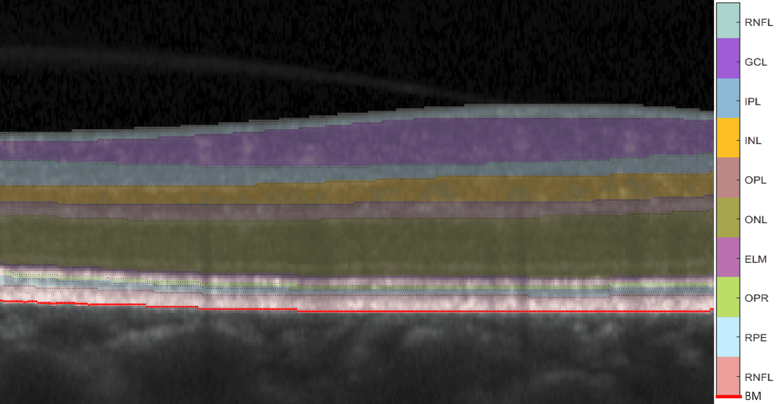 a close-up OCT image of a healthy retina with all ten retinal layers, RNFL, GCL, IPL, INL, OPL, ELM, OPR, RPE and Bruch's membrane, segmented and colored to show how the retina is represented in OCT and how it can be segmented